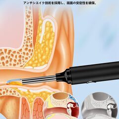 耳かき カメラ付き 耳かき【2025年革新版&2000万画質】耳掃除 3.5mm極細レンズ 左右反転機能 WIFI接続 イヤースプーン IP67防水 カメラ付き耳かき 耳掻きカメラ 耳垢除去 耳垢クリーニング 耳のケア 録画 写真 Type-C充電 子の画像