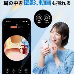 耳かき カメラ付き 耳かき【2025年革新版&2000万画質】耳掃除 3.5mm極細レンズ 左右反転機能 WIFI接続 イヤースプーン IP67防水 カメラ付き耳かき 耳掻きカメラ 耳垢除去 耳垢クリーニング 耳のケア 録画 写真 Type-C充電 子の画像