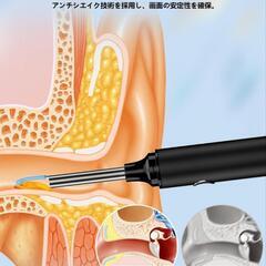 高性能スマート可視耳かき✨の画像