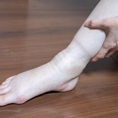 貴女の慢性的な足の浮腫みはお医者様から処方されているお薬を…