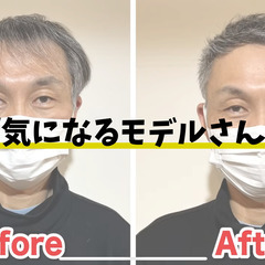 薄毛が気になるモデルさん募集！※無料