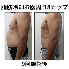 ✨世界最先端大注目の無料体験　脂肪冷却＋筋肉増量✨ - 美容