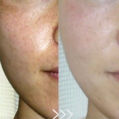 現役セラピストが教える《エステ級の美肌個人レッスン》の画像