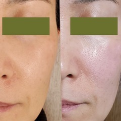 現役セラピストが教える《エステ級の美肌個人レッスン》の画像
