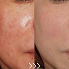 現役セラピストが教える《エステ級の美肌個人レッスン》の画像