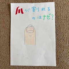 爪が割れるのは？