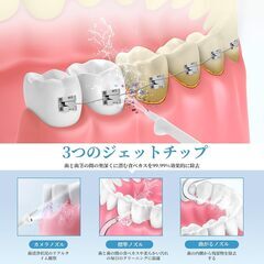 口腔洗浄器　カメラ付の画像