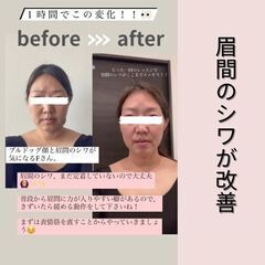 6月、7月　オンライン顔ヨガ　1000円（半額）顔ヨガ！たるみ改善道場・小顔・ほうれい線・二重あご・表情筋・しわの画像