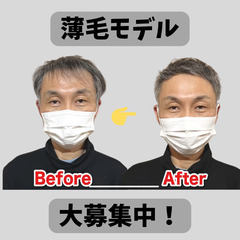 薄毛が気になるモデルさん募集！※無料