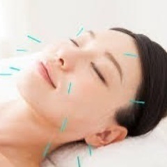 【女性優先／6月17日(月)】美容鍼灸・整体の無料体験モニ…