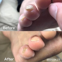 ◆足のケア(爪切り)をします！