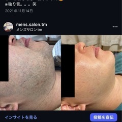 メンズ脱毛　やってみませんか？（北谷町） - 美容