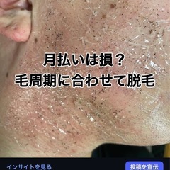 メンズ脱毛　やってみませんか？（北谷町） − 沖縄県