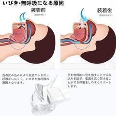 いびき マウスピース いびき防止グッズ 舌用マウスピース いびき防止グッズの画像
