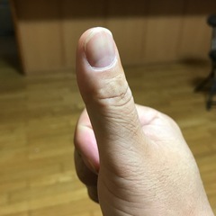 近い場所限定鈑金塗装！