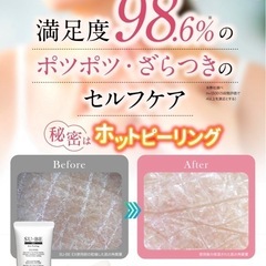 【新品】スーベEX 首イボケア ホットピーリングジェル 40gの画像