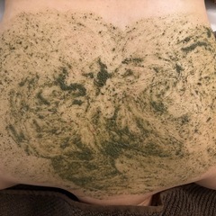 【肌荒れ・ニキビにお悩みの方へ】押上駅すぐ！ハーブピーリン…