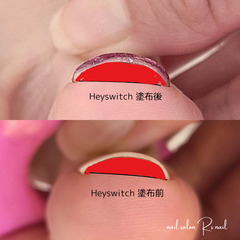 巻き爪ケア&ネイル