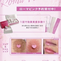 【札幌】最安値✨ローマピンク💋モニター募集❣️