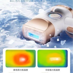 在庫一掃セール‼️冷却機能付き脱毛器 男女兼用 全身/顔/VIOの画像