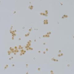 🌈篤姫メダカ有精卵３５粒(保証含む)🌈の画像