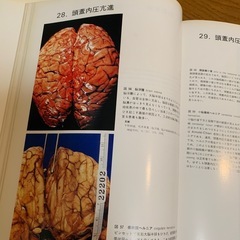 🔴神経病理 医学書⑤の画像