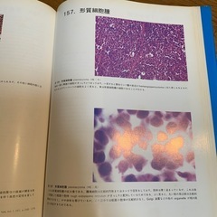 🔴神経病理 医学書⑤の画像