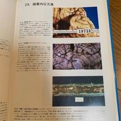 🔴神経病理 医学書⑤の画像