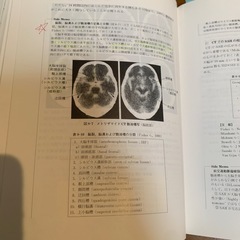 🔴脳神経外科 医学書⑩の画像
