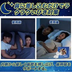 😴いびき防止クリップ【4個セット・専用ケース付】ノーズクリップ 鼻呼吸 睡眠サポートグッズ 安眠 鼾対策 男女兼用 鼻詰まり 旅行 水洗い 清潔 衛生 鼻腔拡張 シリコン 軽量 コンパクト 睡眠補助グッズ 快眠の画像