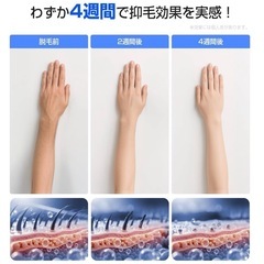 お得✨光冷感脱毛器の画像