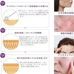 マイクロニードルローラー 0.5mm 美容ローラー フェイスローラーの画像