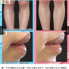 ReFa EPI GO(リファ エピ ゴーの画像