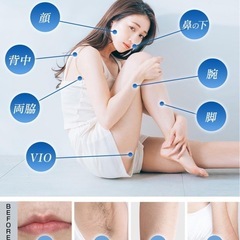 【期間限定50%OFF】KosBeauty 脱毛器 冷却機能付 99万回照射9段階モード
の画像