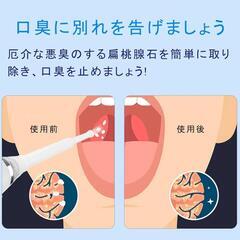 扁桃石 吸引 口臭予防の画像