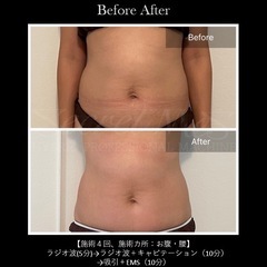 《美品》Secretmes 【シークレットメス】美顔痩身複合機/定価260万円の画像
