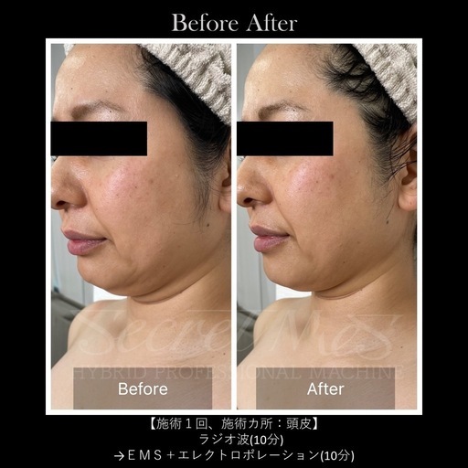 《美品》Secretmes 【シークレットメス】美顔痩身複合機/定価260万円→82%引き