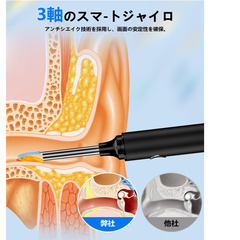   👂【新品未使用】Joigeo カメラ付き耳かき 2025年革新版 3000万画素 WiFi接続 3.5mm極細レンズ LEDライト IP67防水 耳掃除 録画・写真対応 Type-C充電 子供/大人/お年寄り 日本語説明書付き (ブラック)の画像