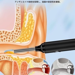 【新品未使用】耳かき カメラ付き 耳かき 2000万画質 耳掃除 3.5mm極細レンズの画像