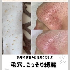 【毛穴・肌質改善専門】AbyO Aesthetic salon 2025.8/4 西千葉駅南口徒歩10秒にNEW OPEN✨ 毛穴の黒ずみ・開き・ざらつきに特化した女性専用エステサロン。 15年以上の経験を活かした丁寧なカウンセリングと上質なオールハンド施術で、肌本来の美しさを引き出します。 今なら最大50％OFFキャンペーン開催中！ - ボディケア