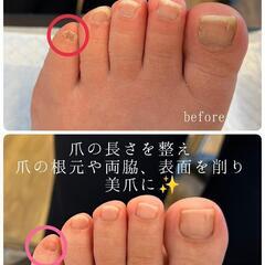 小指の爪のストレス解消しませんか？