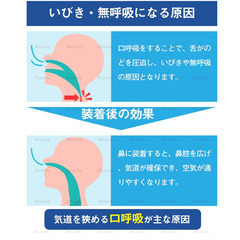 Roamly いびき防止グッズ 2個セット 専用ケース付き 磁気式 ノーズクリップ 鼻腔拡張 鼻呼吸促進 シリコン製 水洗い可能 男女兼用 透明色の画像