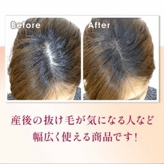 ヘアモーメント ダークブラウン 女性の薄毛隠しの画像