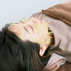 あなた史上最高のもち肌へと導く【肌質改善専門】美容鍼サロン 