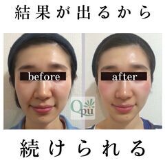 小顔矯正サロンオーナー募集！伊勢崎店（仮名）新規オープン【小顔矯正サロンQpu】の画像