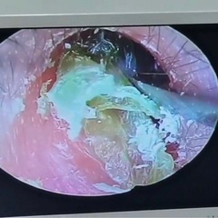 耳かき大好きな方必見❣️イヤーセラピスト募集の画像