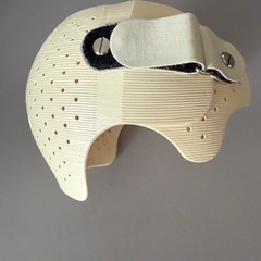 ベビーバンド　ヘルメット治療の画像