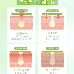 Qiera アゼライン酸 美容液の画像
