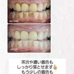 キャンセル出ました！セルフホワイトニング施術！の画像