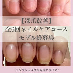 【人数限定】【深爪改善】全6回ネイルケアコース
